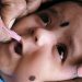 Pulse Polio immunization drive